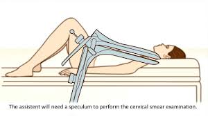 The test results help your healthcare providers decide the best ways to treat the cancer. A Cervical Screening Test What Can You Expect Youtube