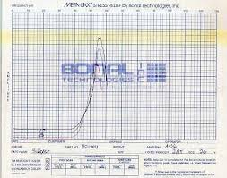 Stress Relieving Chart Example Logue Industries Inc