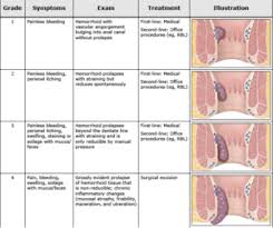 Image result for Hemorrhoid