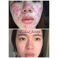 « un rêveur est celui qui ne trouve son chemin qu'au clair de lune et qui, comme punition, aperçoit l'aurore avant les autres hommes. Qoo10 Clair De Lune Day And Night Refining Cream Skin Care