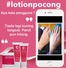 Untuk order dan penerangan produk atau konsultasi cara hilangkan parut chicken pox boleh hubungi saya: Beautyspells Tiada Lagi Kuning Langsat Wow Facebook