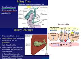 Image result for Biliary Colic