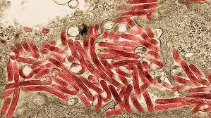 El virus de marburg (marv) causa la enfermedad del virus de marburg en humanos y primates no humanos , una forma de fiebre hemorrágica viral. Towyu5kgs1wtbm
