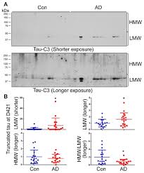 Chopping board & knife bowl. Relevance Of Phosphorylation And Truncation Of Tau To The Etiopathogenesis Of Alzheimer S Disease Abstract Europe Pmc