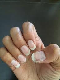 Read on to discover what oral cancer may look like, its symptoms, and how to differentiate it from other conditions. Nail Signs The Cancer Scare Naked Truth By Dr Melanie