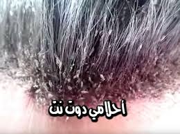 الثلاجة هي أحد أكثر أهمية الأجهزة الكهربائية التي يستخدمها الناس والتي لا يمكن الاستغناء عنها في أي منزل فساعدت الناس كثيراً وسهلت عليهم أسلوب الاحتفاظ بالطعام بعدما كانوا يواجهون صعوبة هائلة في تخزينه لفترة أطول، وكانوا يلجؤون لبعض الأساليب البدائية. Ø±Ø¤ÙŠØ© Ø§Ù„Ù‚Ù…Ù„ ÙÙŠ Ø§Ù„Ù…Ù†Ø§Ù… ÙˆÙ‚ØªÙ„Ù‡