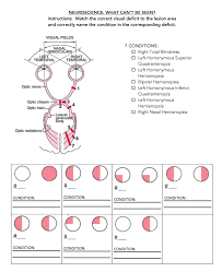Image result for Visual Field Deficit
