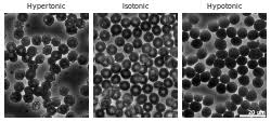 B) plasmolysis will shrink the interior. Cytolysis Wikipedia