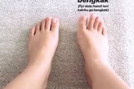 Apakah kaki bunda sekarang bengkak? 6 Solusi Mengatasi Kaki Bengkak Saat Hamil Dan 4 Penyabnya Jangan Minum Obat Pelancar Kencing Semua Halaman Grid Health