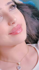 Filler for lips , اديش بتعطو من عشرة 🙈🤭, ., ., ., By Dr : Sawsan Nashar,  For booking:, 099670646, #filler #botox #trend #beauty #skin #glow