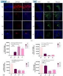 Biomedicines | Free Full-Text | Cardamonin Exerts Antitumor Effect on Human  Hepatocellular Carcinoma Xenografts in Athymic Nude Mice through Inhibiting  NF-κβ Pathway