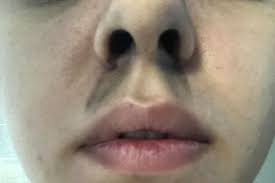 Woman Nearly Died From Soot In Lungs After Leaving Candle Burning As She Slept Mirror Online