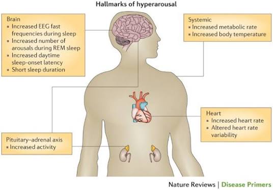 Insomnia disorder | Nature Reviews Disease Primers