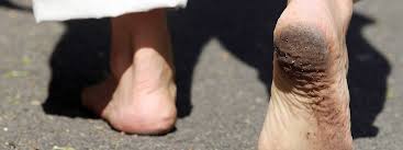 Mein name ist thomas müller. Unsere Fusse Sind Nicht Fur Schuhe Vorgesehen Evolutionsbiologisch Mdr De