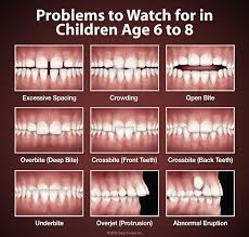 How long will it take for braces with rubber bands to correct a 100% overbite? Early Treatment Berlin Children S Orthodontics Braces Salisbury
