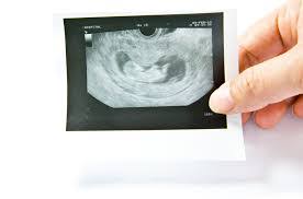 Maybe you would like to learn more about one of these? Cara Paling Tepat Untuk Tahu Jantina Bayi Dalam Kandungan