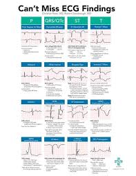 Pin By Tairyn Soczek On Nurse Emergency Nursing Cardiology Nursing Emergency Medicine