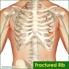 There are twelve (12) pairs of ribs and all articulate posteriorly with the thoracic vertebrae. Pain Under Left Rib Cage Treatment Causes Diagnosis