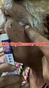 Haloderm Cream In Pakistan,Lahore,Karachi,Islamabad