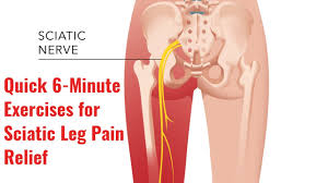 Sciatica pain can be unbearable. Top 7 Exercises For Sciatic Pain Relief Fornham Chiropractic Clinic