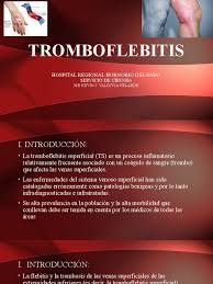 Check spelling or type a new query. Tromboflebitis Pdf Trombo Droga Anti Inflamatoria Libre De Esteroides