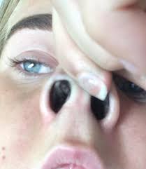 Pictures of the inside of the nose. Took This Picture Days Later Realized Kanye West Is Hiding Inside My Nose Imgur