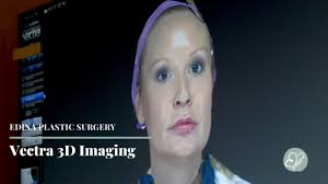 Why Choose Us Edina Plastic Surgery