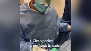 Breast Augmentation 5 Important Things To Ensure No Post Operative Complications By Beverly Hills Plastic