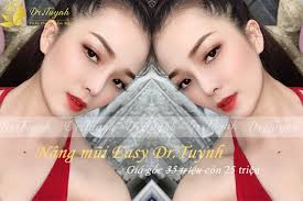 CÁCH XÁC ĐỊNH MỤC TIÊU NÂNG MŨI CHO MÌNH HỢP LÝ (Những điều cần biết khi  nâng mũi