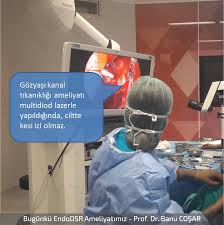 Goz Yasi Kanali Tikanikligi Ameliyati Acik Ve Kapali Yontem Ile Yapilir Acik Yontemde Ciltte Kesi Olurken Multidiod Lazerle Yapila Gozler Kanal Yastiklar