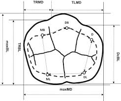 Check spelling or type a new query. Crown Morphology Of The Mandibular First Molars With Distolingual Roots Sciencedirect