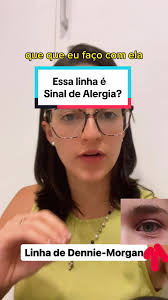 Linha de Dennie-Morgan. Já ouviu falar? Já percebeu em você ou no seu  filho? #alergologia #alergiarespiratoria #alergia #rinite #asma  #dermatiteatopica #alergoresponde