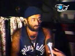 Bene, prendendo spunto da questo particolare fenomeno, peraltro molto comune, (ricordate il compianto lucio dalla?), si può pensare ad un trapianto di peli corporei sulle zone diradate del cuoio capelluto, esattamente con un trapianto di capelli fue. Lucio Dalla Si Confessa Youtube