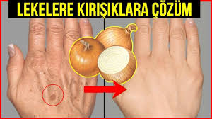 Eldeki Lekeler Kirisiklar Icin Mucize Sogan Maskesi El Genclestirme Tarifi Guzellik Bakim Youtube Guzellik Saglik Cilt Bakimi