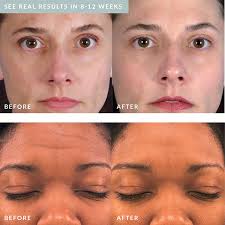 Pmd microdermabrasion zu hause ♥ review ♥ elen pruefer. Pmd Personal Microderm Microdermabrasion Amazon De Drogerie Korperpflege
