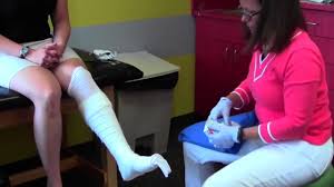 Image result for Short Leg Cast