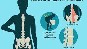 We did not find results for: Cause And Treatment Of Low Back Stiffness