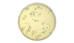 Listeria monocytogenes is a type of bacteria that can cause food poisoning. Compass Listeria Agar Chromogenic Media Noack