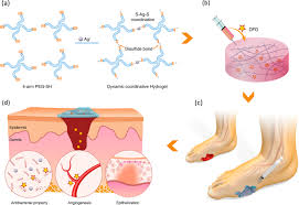 How can a diabetic wound heal faster. An Injectable Self Healing Coordinative Hydrogel With Antibacterial And Angiogenic Properties For Diabetic Skin Wound Repair Npg Asia Materials