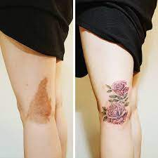 Ink can also seep into underlying tissues and mimic the spread of metastatic melanoma. 15 Creativos Tatuajes Que Convierten Las Marcas De Nacimiento En Verdaderas Obras De Arte Birthmark Tattoo Cover Up Tattoos Up Tattoos