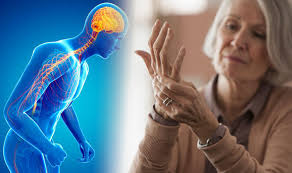 The medical treatment of parkinson disease from james parkinson to george cotzias. Parkinson S Symptoms Four Main Signs Of The Disease To Watch Out For Express Co Uk