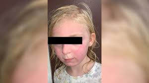 Jennifer aniston without makeup looks is trending in town. Yes To Unicorn Face Mask Pulled From Shelves After Reports Of Chemical Burns Abc7 Chicago
