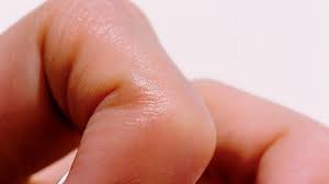 Why Are My Nails Peeling Allure