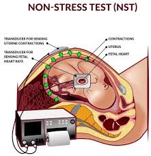 Image result for Contraction Stress Test