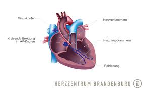 Ablation Von Av Knoten Reentry Tachycardien Herzzentrum Brandenburg Bei Berlin