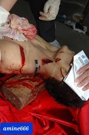 Autopsy of young Chinese man stabbed to death | theYNC