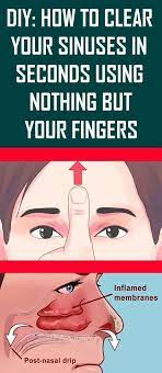 How To Clear Your Sinuses In Seconds Using Nothing But Your Fingers Sinusitis Health How To Clear Sinuses