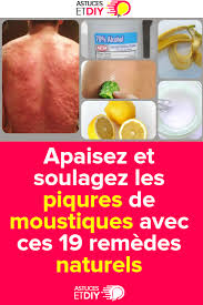 Vous Allez Decouvrir Dans Cette Article Les 19 Remedes Naturels Pour Soulager Les Piqures Des Moustiques Soulager Piqur Hand Soap Bottle Soap Bottle Healthy