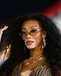 Sheinelle Jones Finally Addresses Prolonged 'Today' Absence