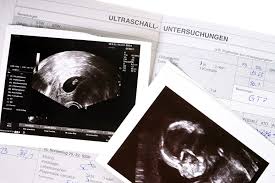 Ab wann ultraschall am bauch?: Die Ultraschalluntersuchung In Der Schwangerschaft Babyartikel De Magazin